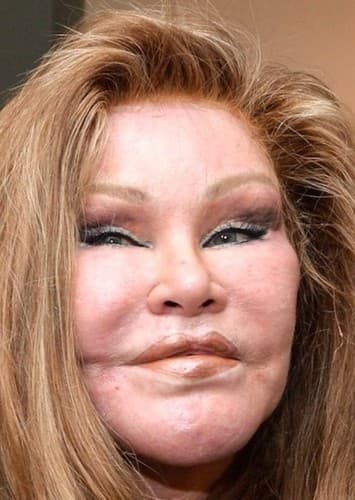 Jocelyn Wildenstein