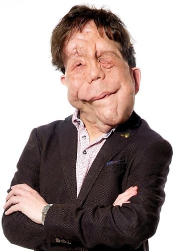 Adam Pearson