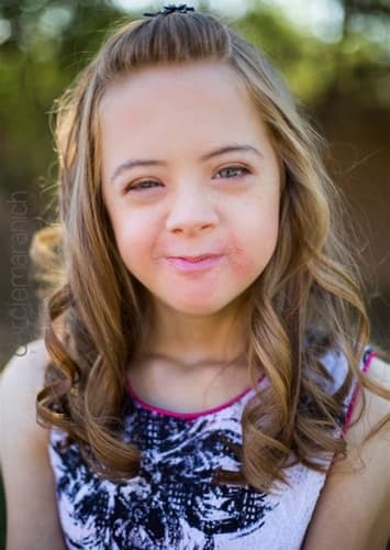 Down Syndrome Princess