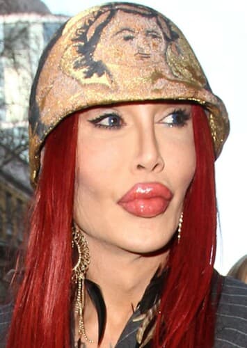 Pete Burns (Now)
